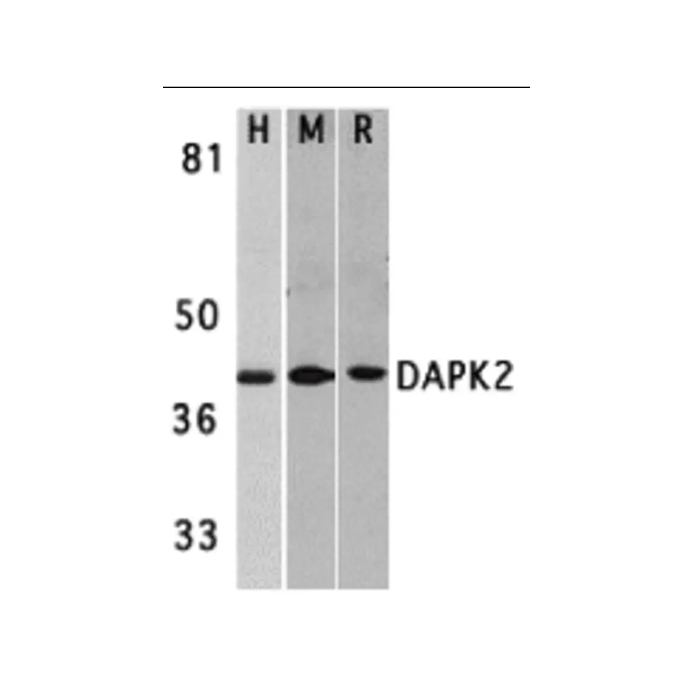 ProSci 2323 DAPK2 Antibody, ProSci, 0.1 mg/Unit Primary Image