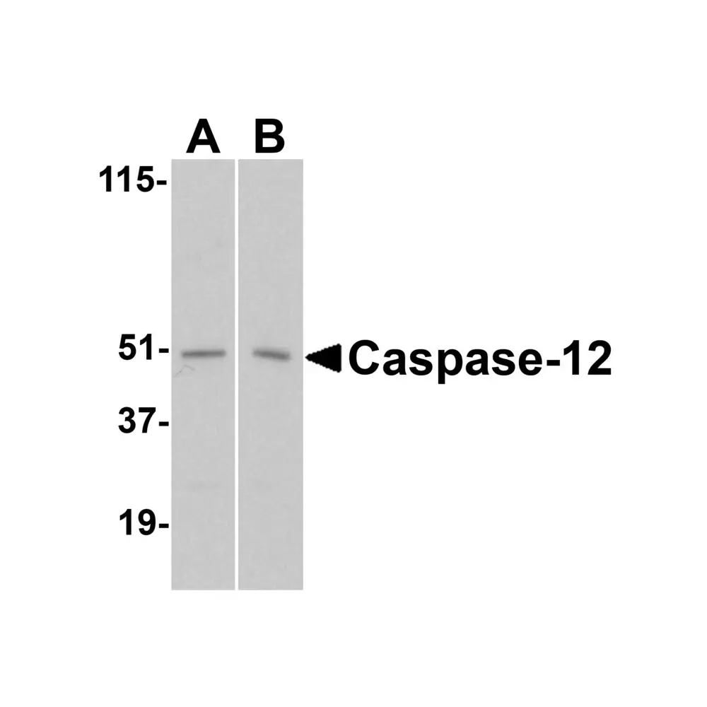 ProSci 2325_S Caspase-12 Antibody, ProSci, 0.02 mg/Unit Primary Image