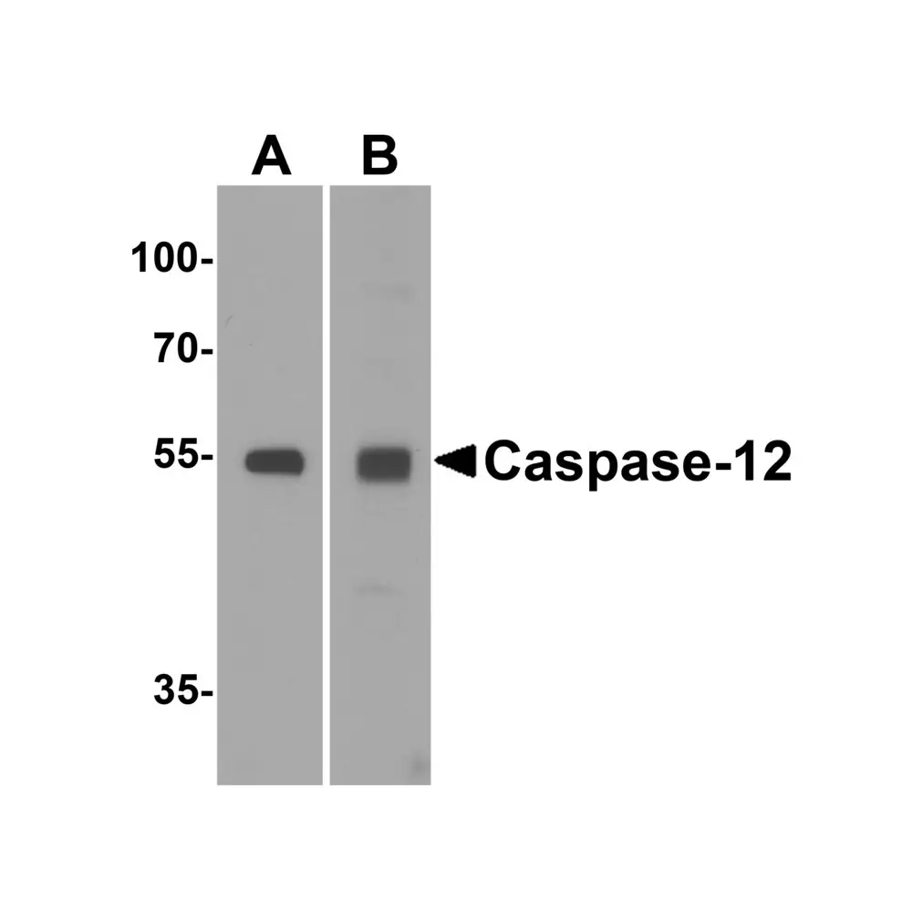 ProSci 2327_S Caspase-12 Antibody, ProSci, 0.02 mg/Unit Primary Image