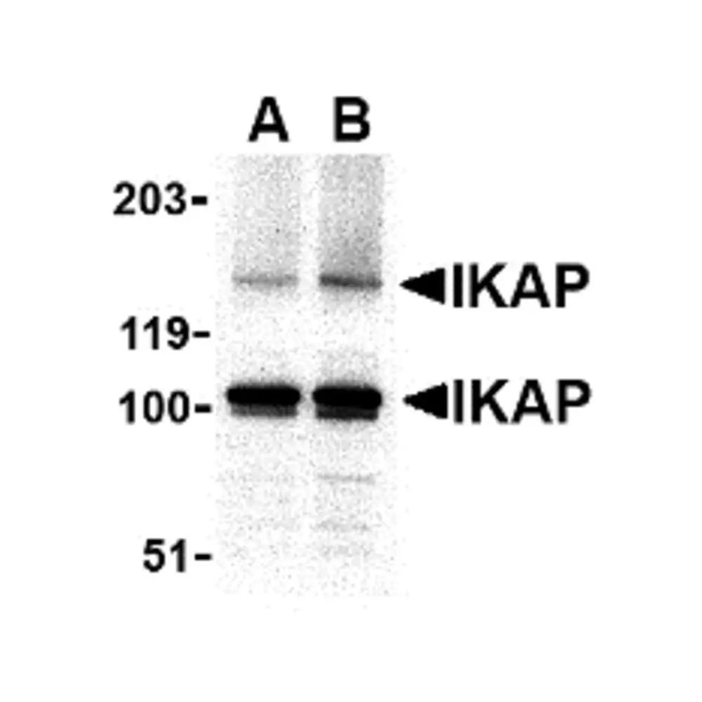 ProSci 2337_S IKAP Antibody, ProSci, 0.02 mg/Unit Primary Image