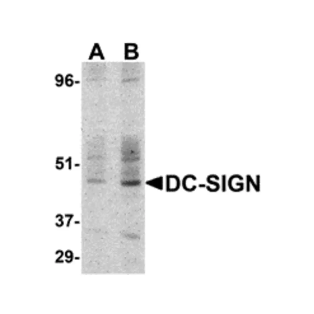 ProSci 2347 DC-SIGN Antibody, ProSci, 0.1 mg/Unit Primary Image