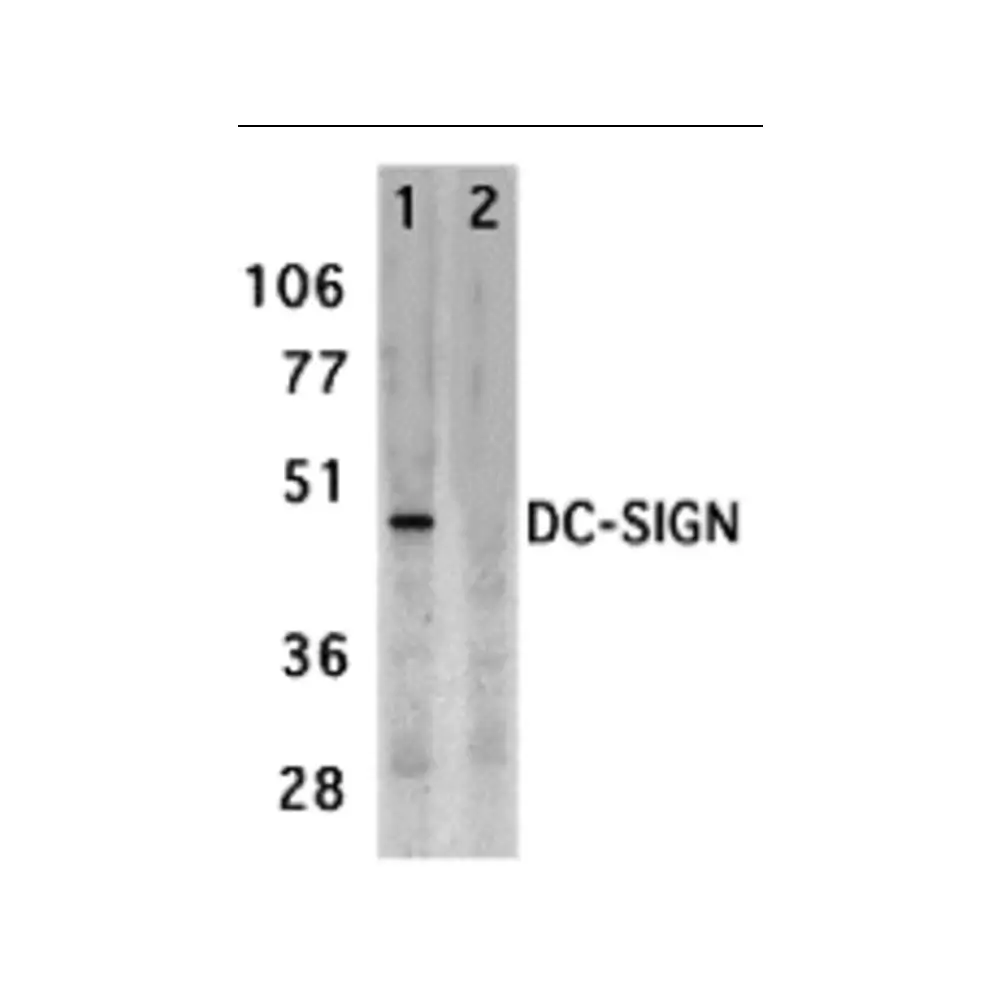 ProSci 2349 DC-SIGN Antibody, ProSci, 0.1 mg/Unit Primary Image