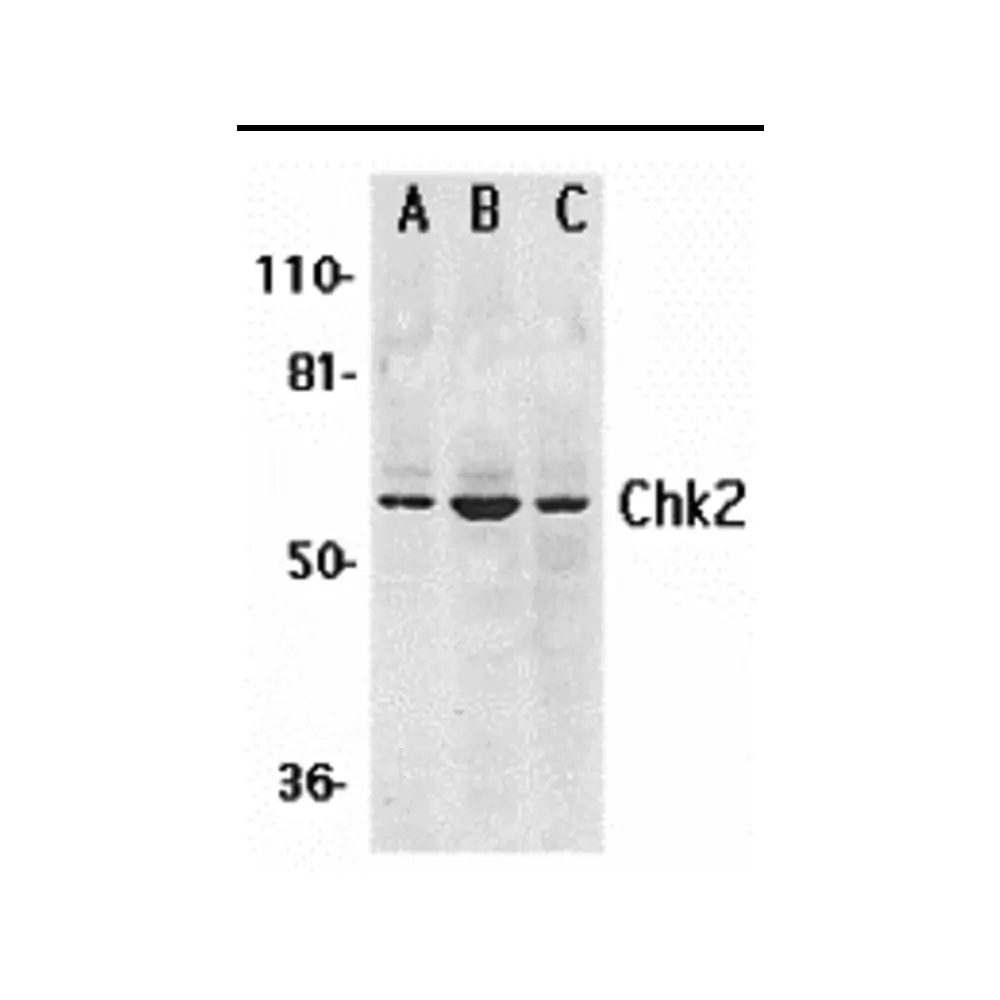 ProSci 2391 Chk2 Antibody, ProSci, 0.1 mg/Unit Primary Image