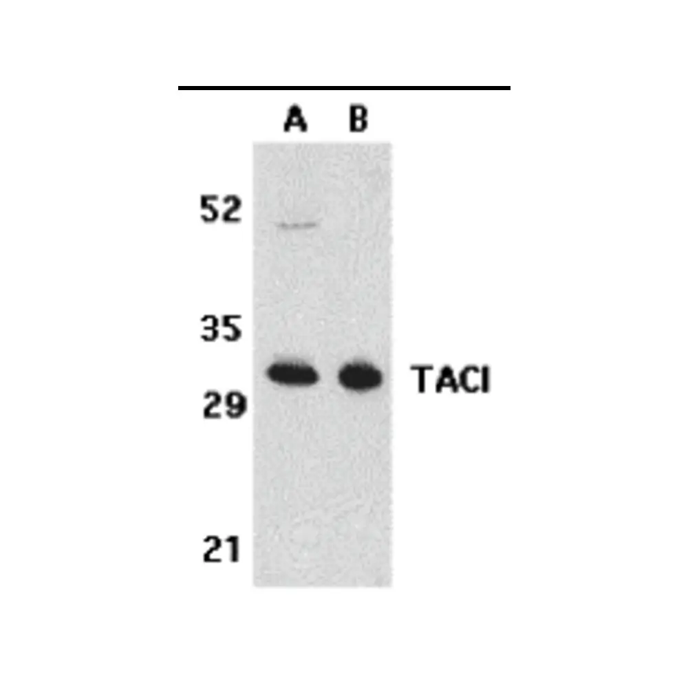 ProSci 2395_S TACI Antibody, ProSci, 0.02 mg/Unit Primary Image