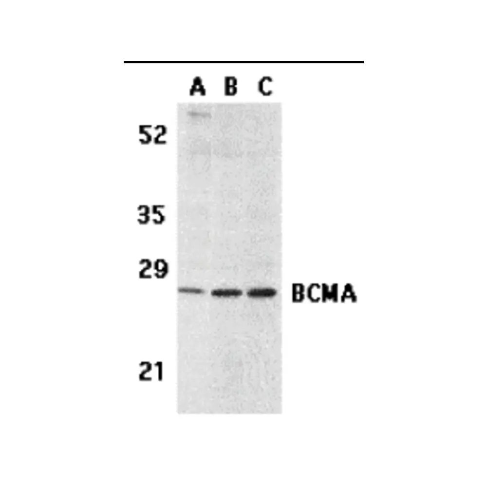 ProSci 2397 BCMA Antibody, ProSci, 0.1 mg/Unit Primary Image