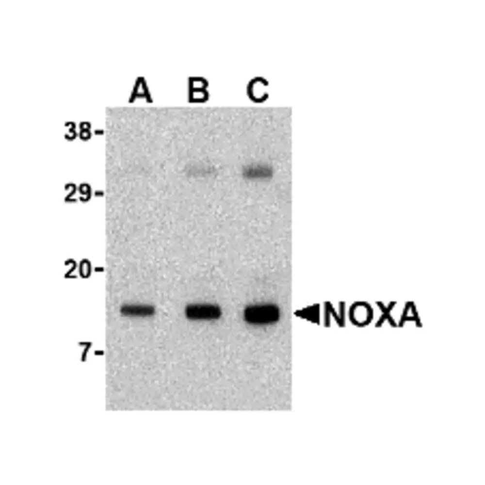 ProSci 2437 Noxa Antibody, ProSci, 0.1 mg/Unit Primary Image