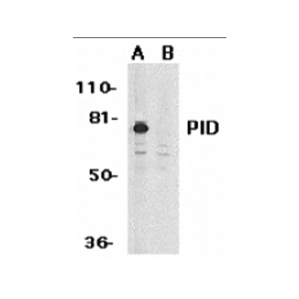 ProSci 2443 PID Antibody, ProSci, 0.1 mg/Unit Primary Image