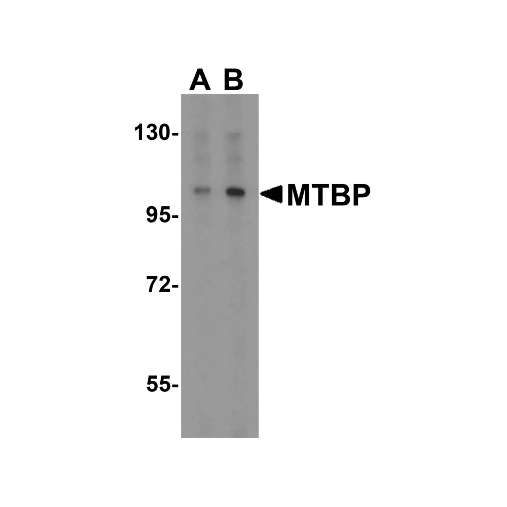 ProSci 2447 MTBP Antibody, ProSci, 0.1 mg/Unit Primary Image