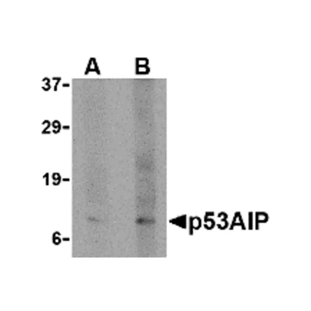 ProSci 2449_S p53AIP1 Antibody, ProSci, 0.02 mg/Unit Primary Image