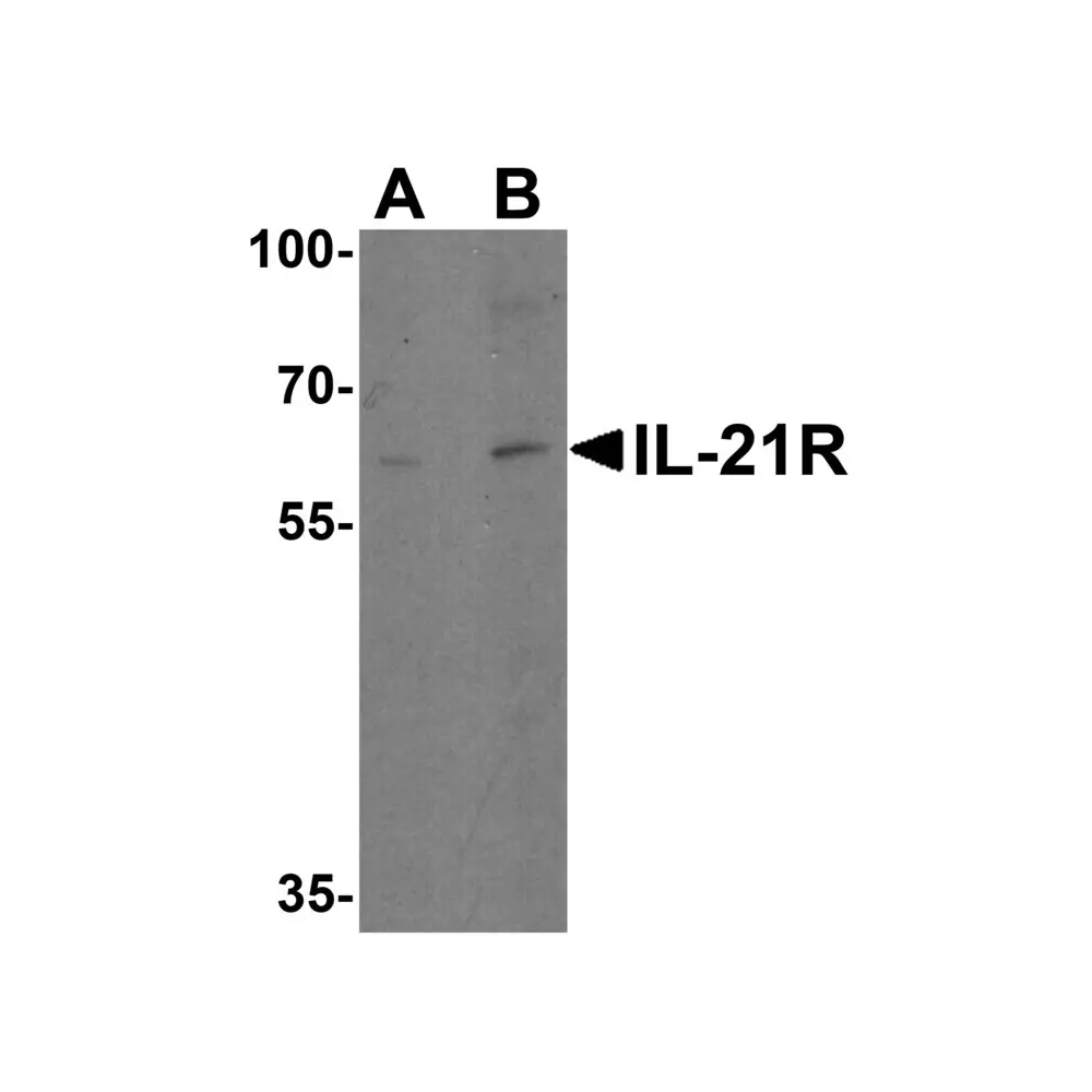 ProSci 2469 IL-21 Receptor Antibody, ProSci, 0.1 mg/Unit Primary Image
