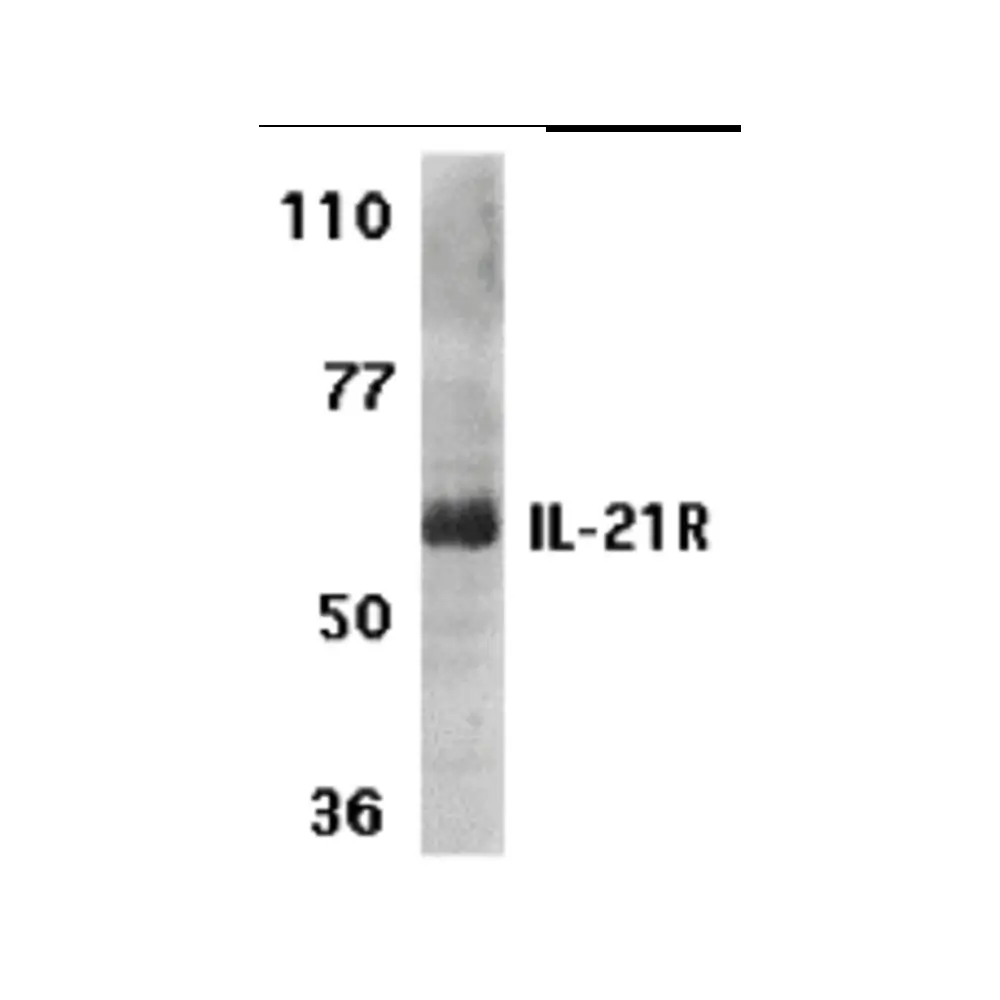 ProSci 2471 IL-21 Receptor Antibody, ProSci, 0.1 mg/Unit Primary Image