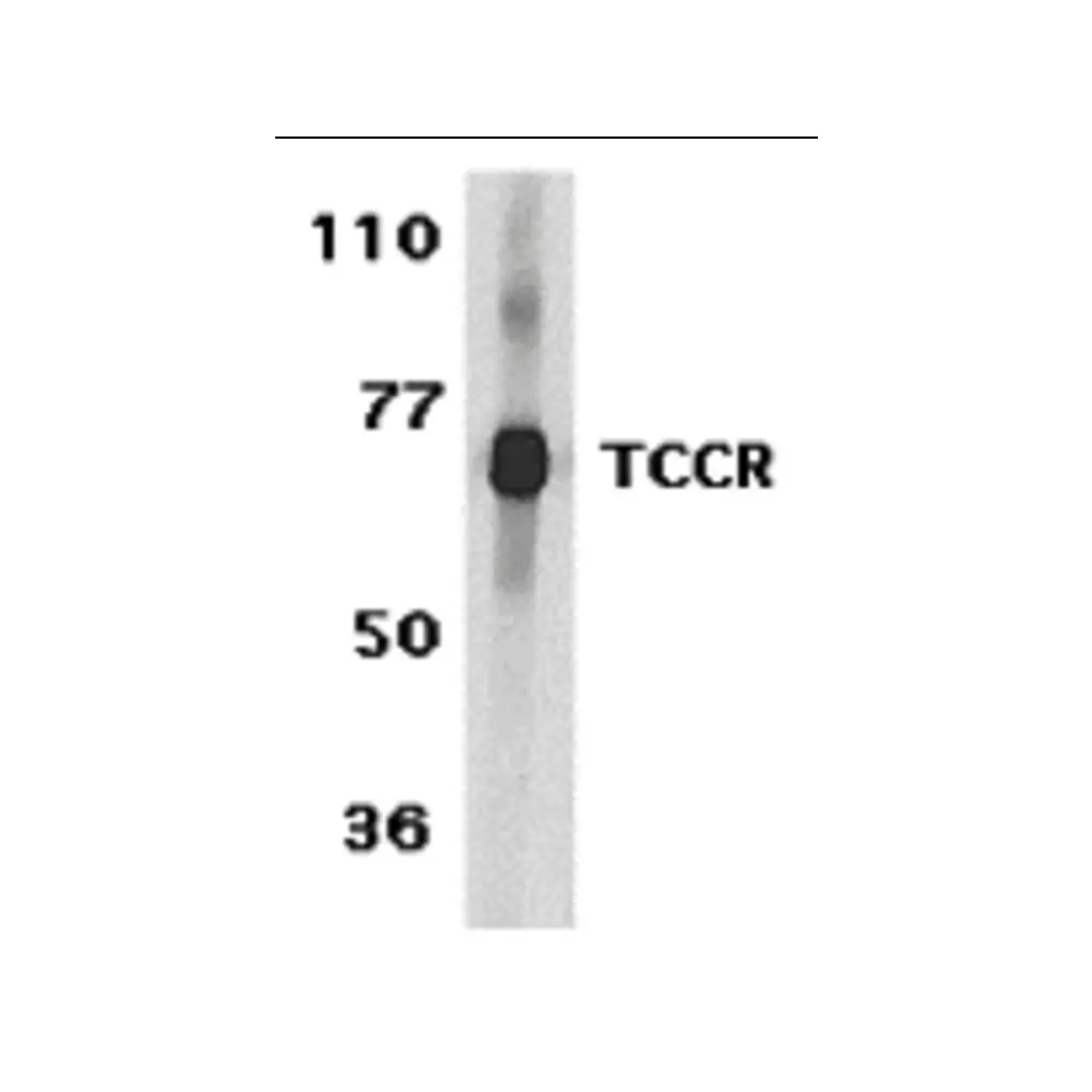 ProSci 2481_S TCCR Antibody, ProSci, 0.02 mg/Unit Primary Image