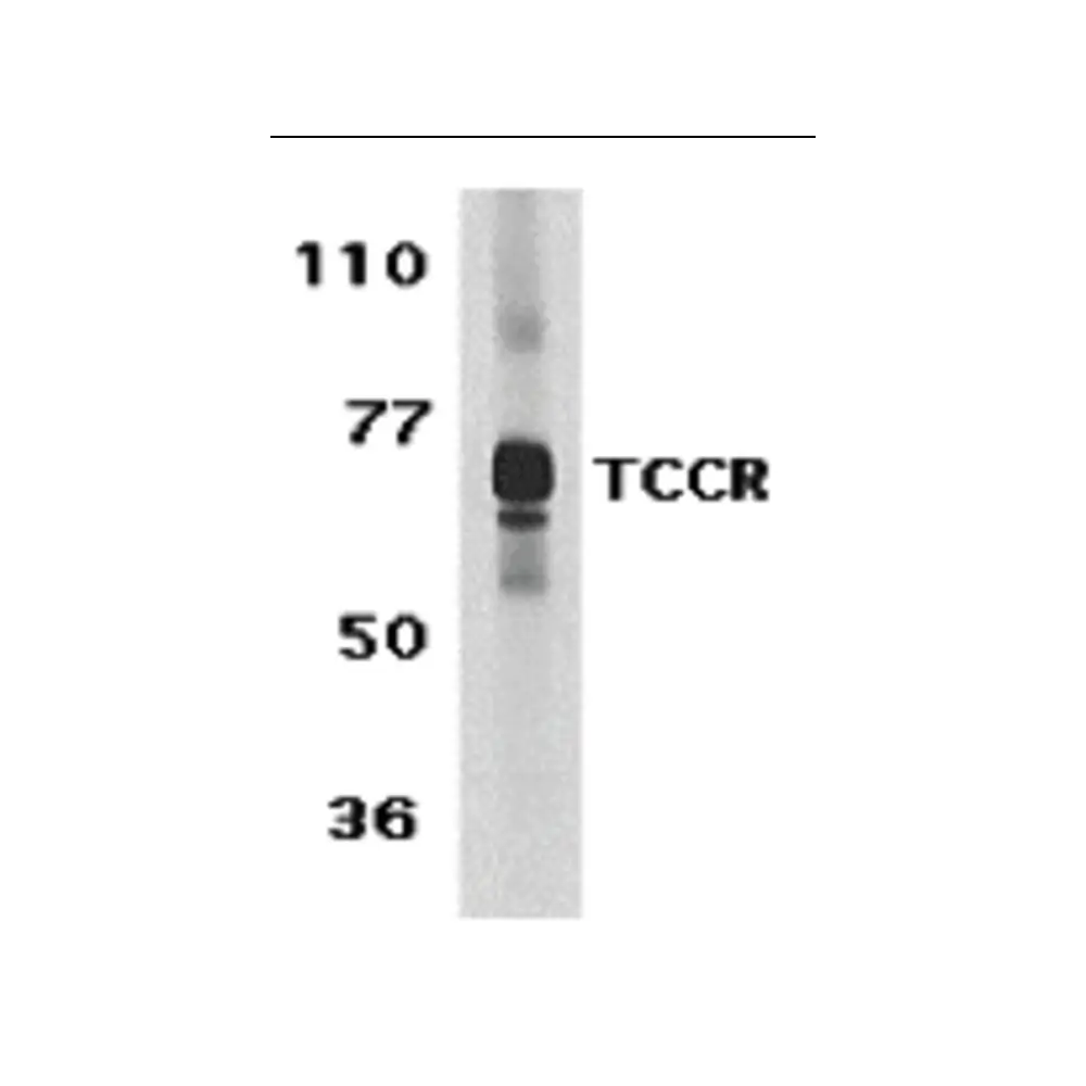 ProSci 2483_S TCCR Antibody, ProSci, 0.02 mg/Unit Primary Image