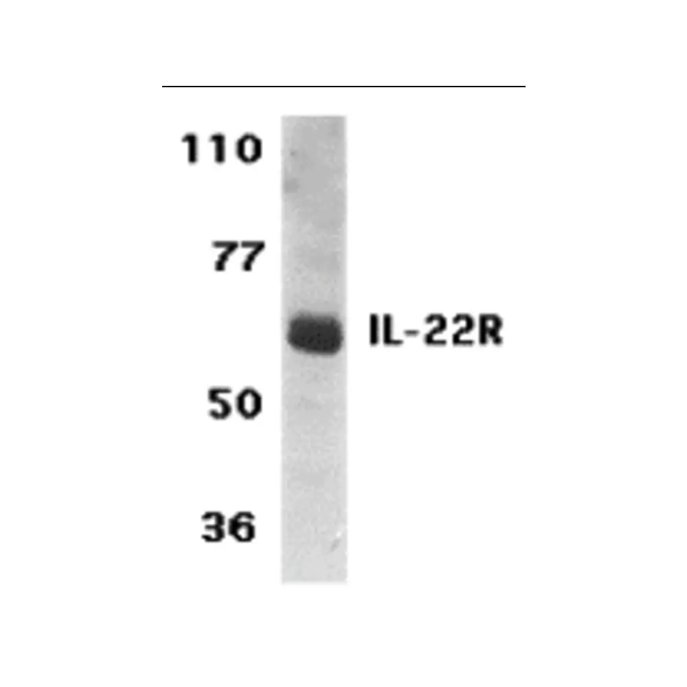 ProSci 2489 IL-22 Receptor Antibody, ProSci, 0.1 mg/Unit Primary Image