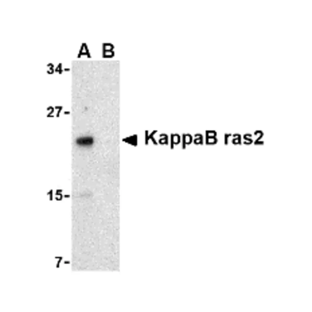 ProSci 2495 KappaB ras2 Antibody, ProSci, 0.1 mg/Unit Primary Image