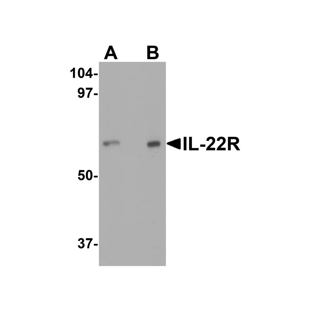 ProSci 2497_S IL-22 Receptor Antibody, ProSci, 0.02 mg/Unit Primary Image