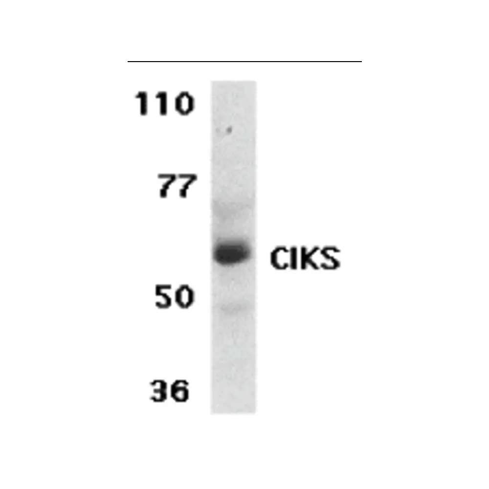 ProSci 2499_S CIKS Antibody, ProSci, 0.02 mg/Unit Primary Image