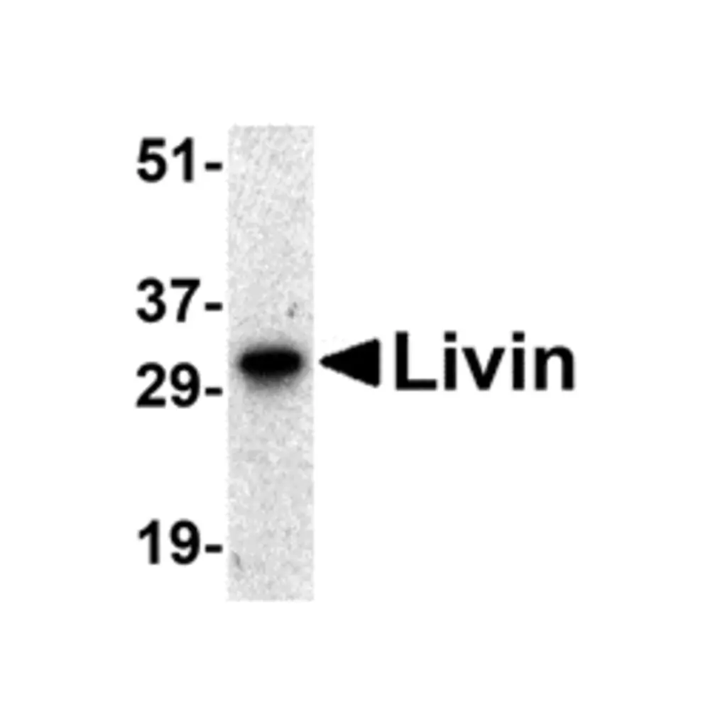 ProSci 2505_S Livin Antibody, ProSci, 0.02 mg/Unit Primary Image