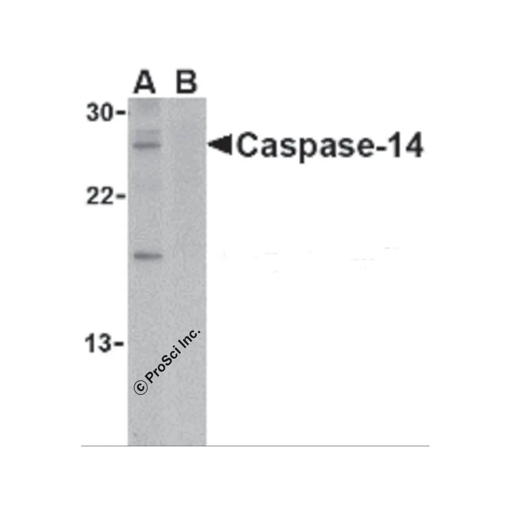 ProSci 2509_S Caspase-14 Antibody, ProSci, 0.02 mg/Unit Primary Image