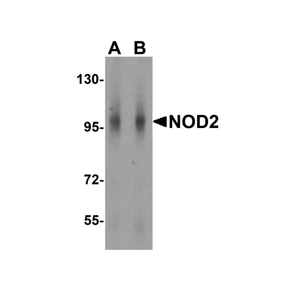 ProSci 2511 NOD2 Antibody, ProSci, 0.1 mg/Unit Primary Image