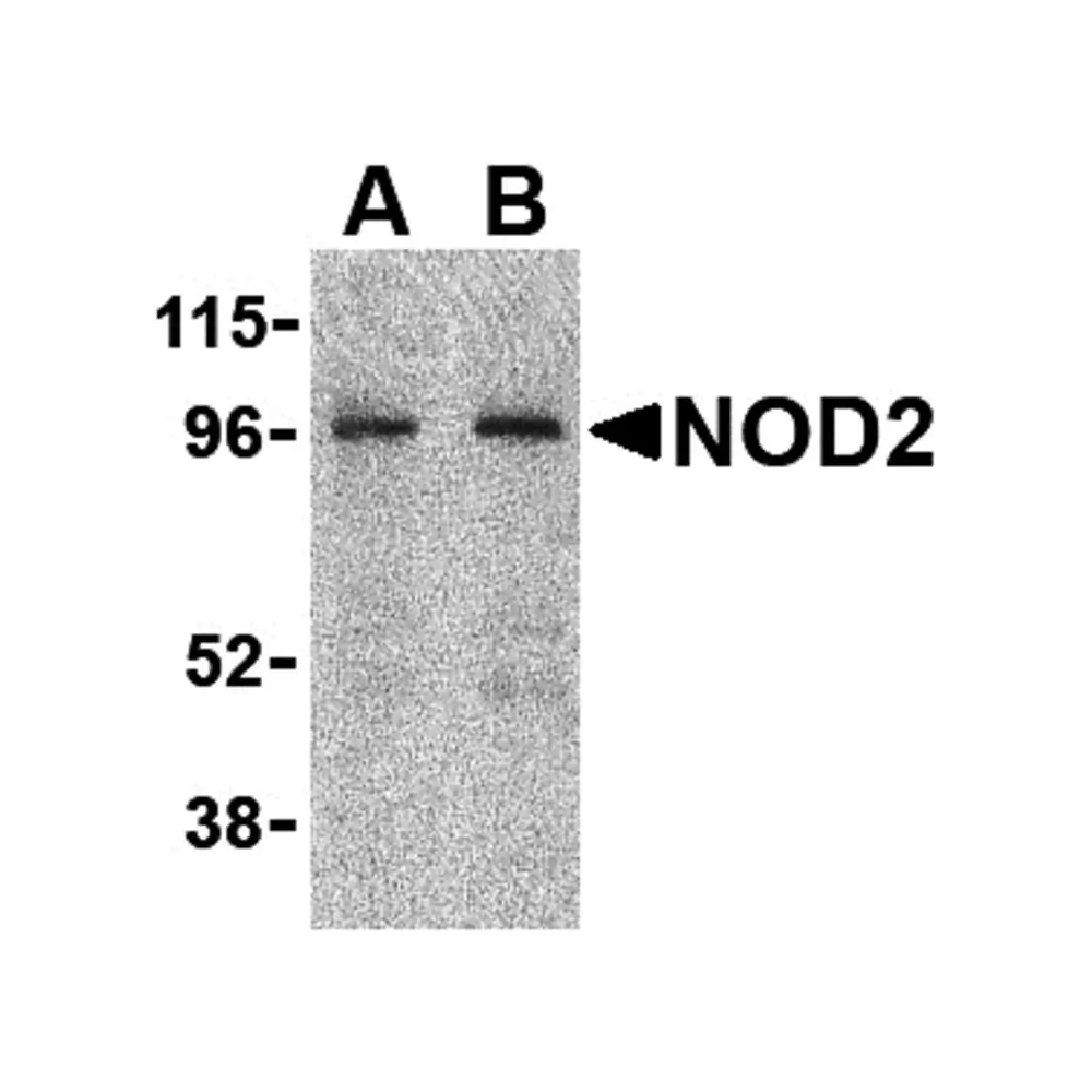 ProSci 2513 NOD2 Antibody, ProSci, 0.1 mg/Unit Primary Image