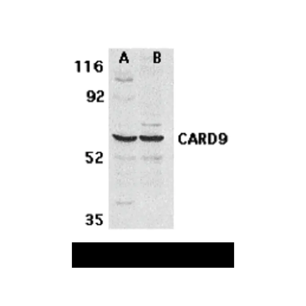 ProSci 2515 CARD9 Antibody, ProSci, 0.1 mg/Unit Primary Image