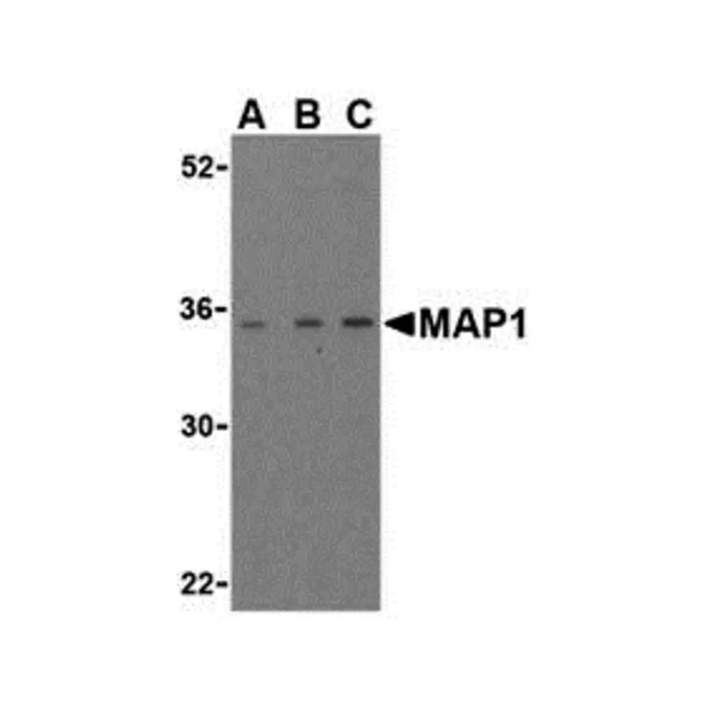 ProSci 3005 MAP1 Antibody, ProSci, 0.1 mg/Unit Primary Image