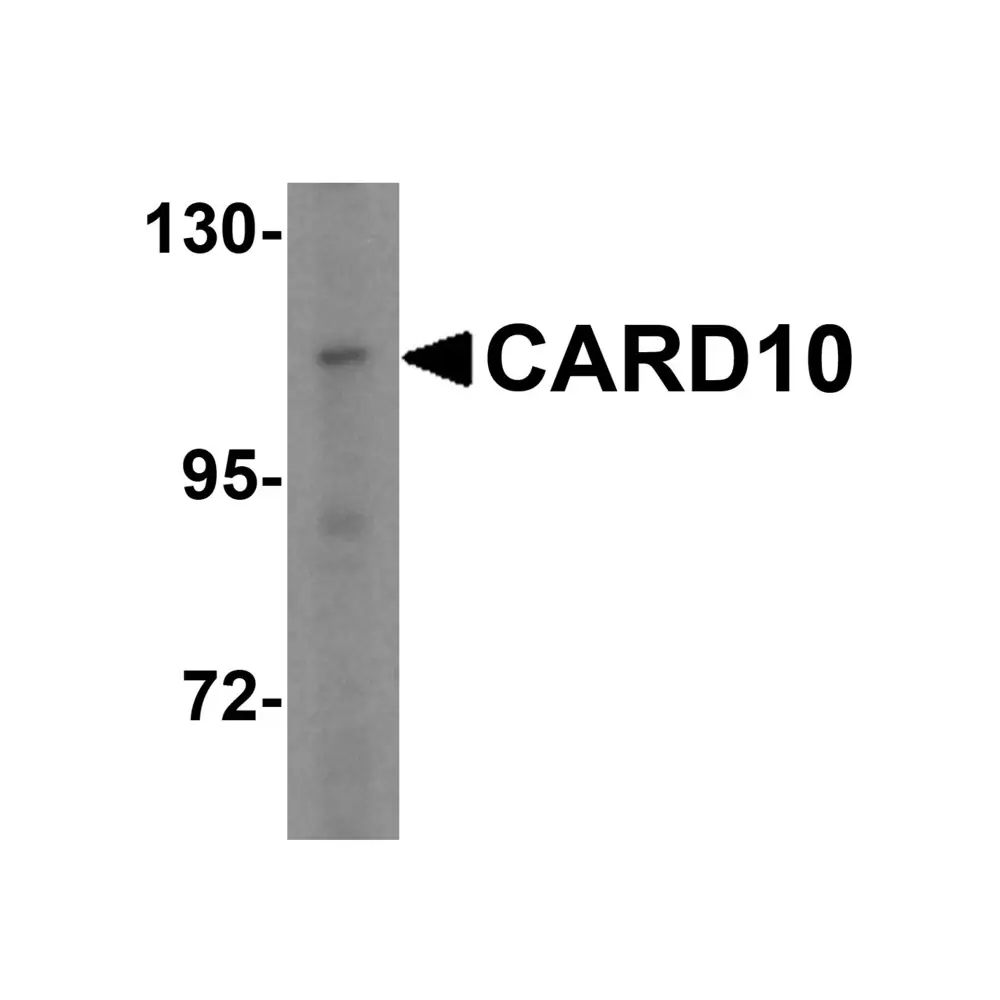 ProSci 3013 CARD10 Antibody, ProSci, 0.1 mg/Unit Primary Image