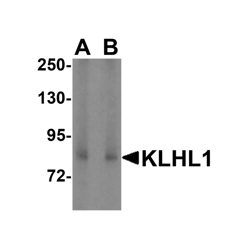ProSci 3015_S KLHL1 Antibody, ProSci, 0.02 mg/Unit Primary Image