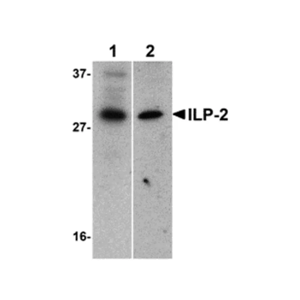 ProSci 3017_S ILP-2 Antibody, ProSci, 0.02 mg/Unit Primary Image