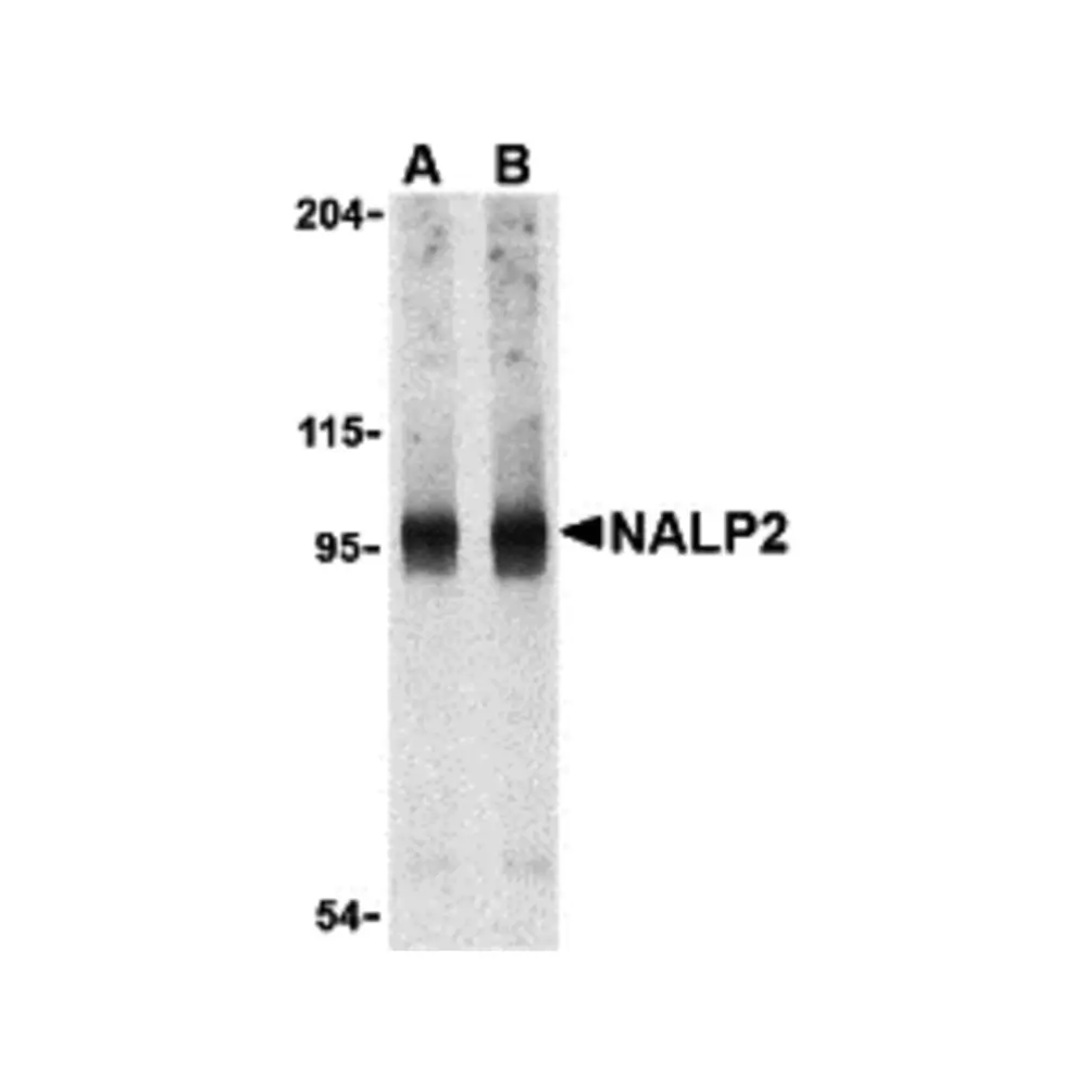 ProSci 3027 NALP2 Antibody, ProSci, 0.1 mg/Unit Primary Image