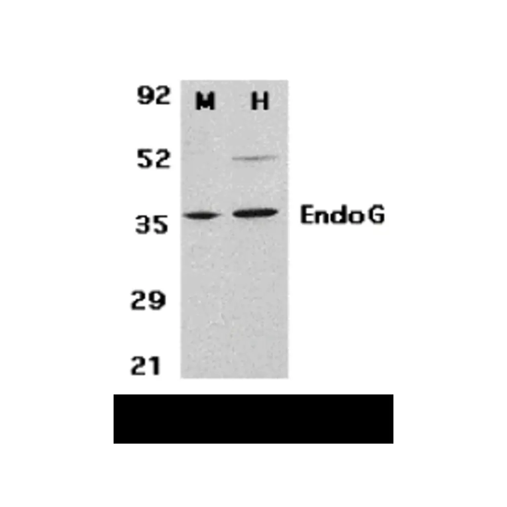 ProSci 3035 EndoG Antibody, ProSci, 0.1 mg/Unit Primary Image