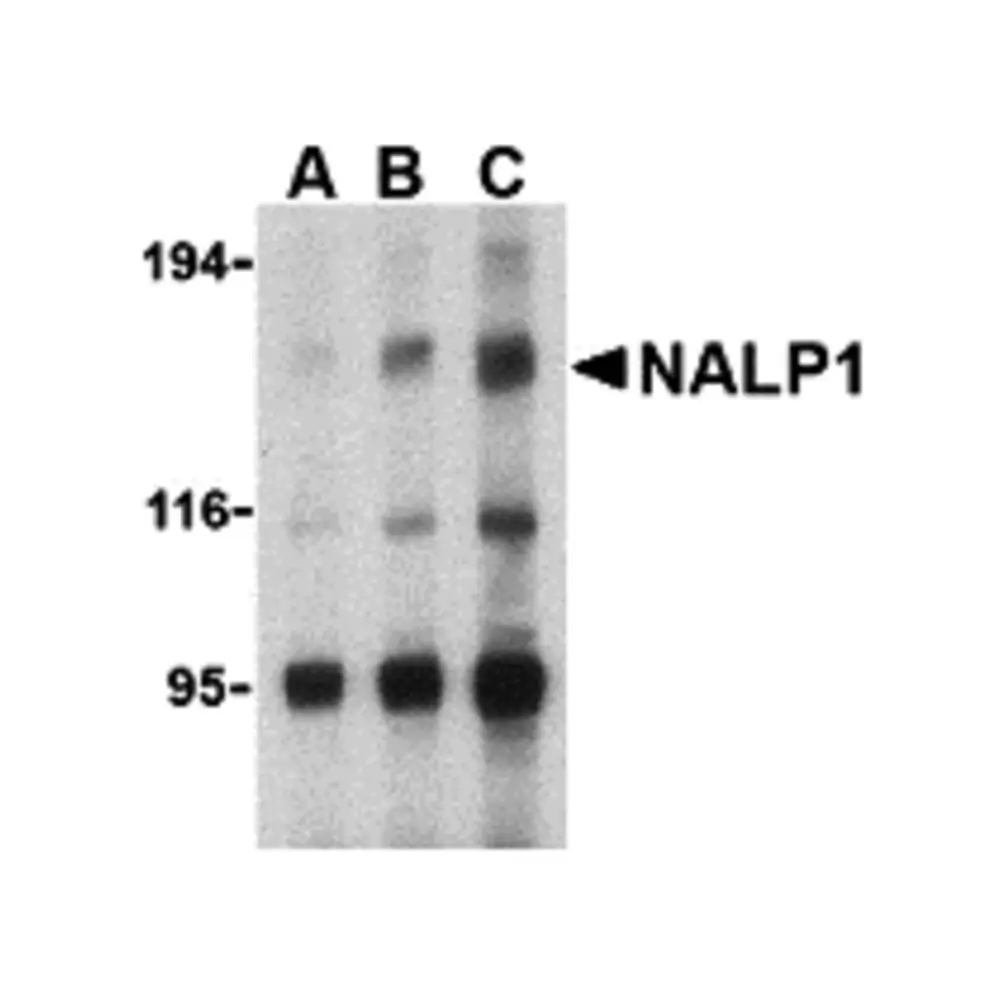 ProSci 3037 NALP1 Antibody, ProSci, 0.1 mg/Unit Primary Image