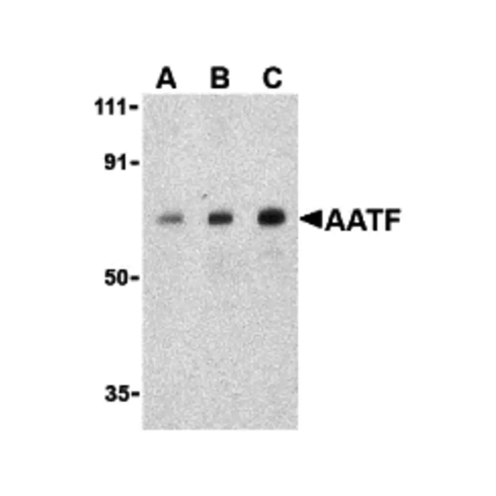 ProSci 3039 AATF Antibody, ProSci, 0.1 mg/Unit Primary Image