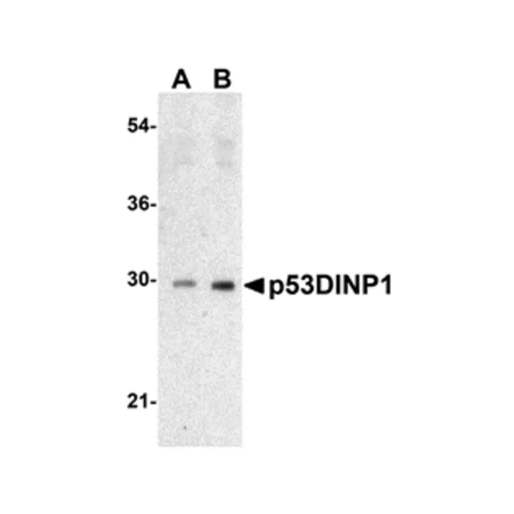 ProSci 3045_S p53DINP1 Antibody, ProSci, 0.02 mg/Unit Primary Image