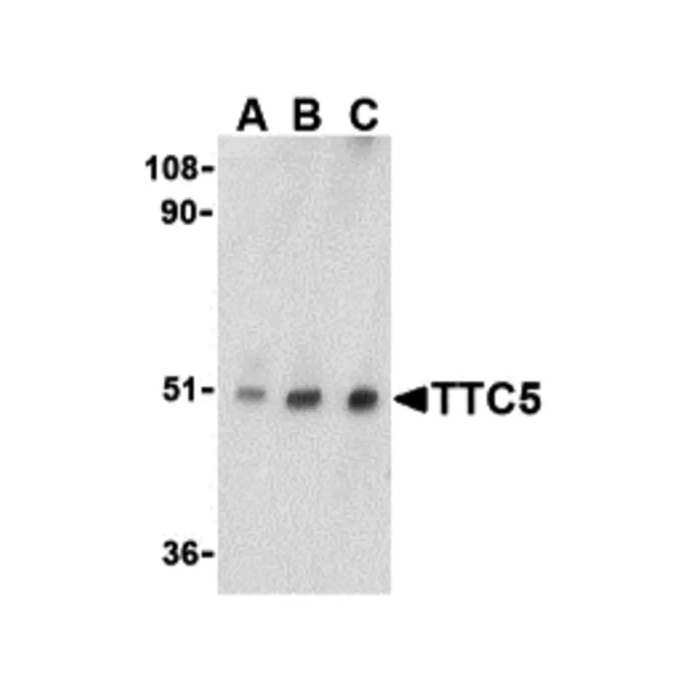 ProSci 3053_S TTC5 Antibody, ProSci, 0.02 mg/Unit Primary Image