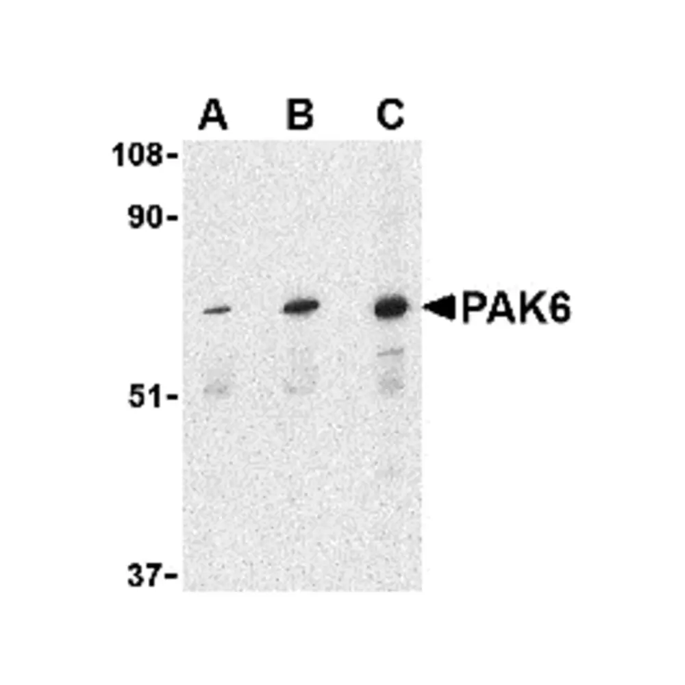 ProSci 3073 PAK6 Antibody, ProSci, 0.1 mg/Unit Primary Image