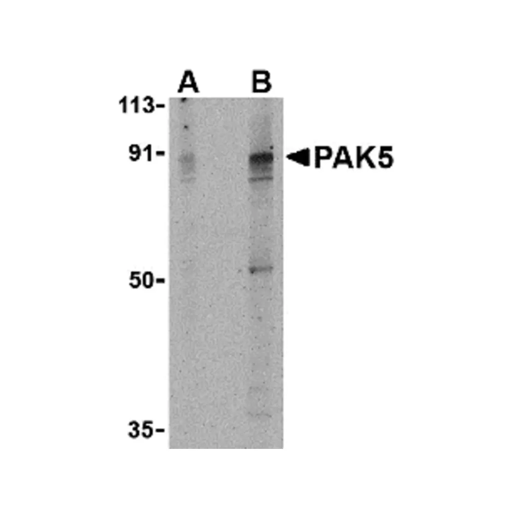 ProSci 3075 PAK5 Antibody, ProSci, 0.1 mg/Unit Primary Image