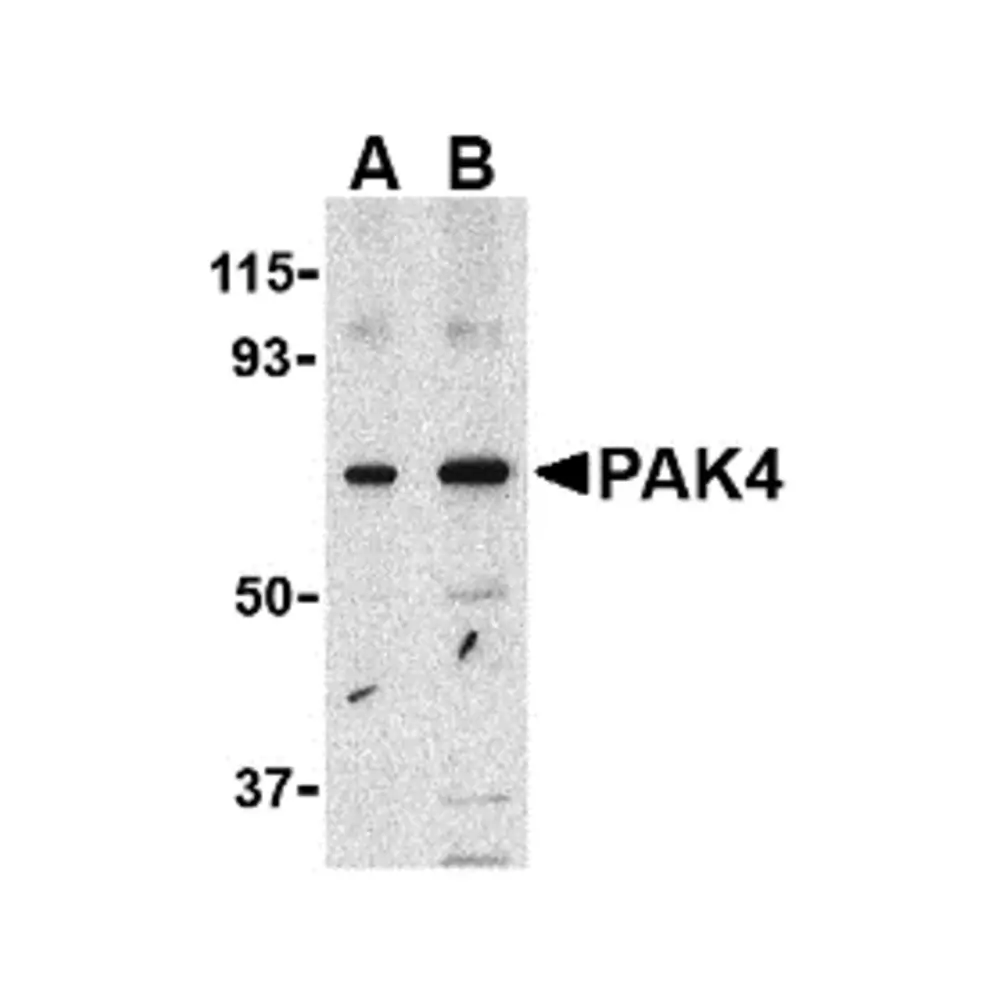 ProSci 3077 PAK4 Antibody, ProSci, 0.1 mg/Unit Primary Image