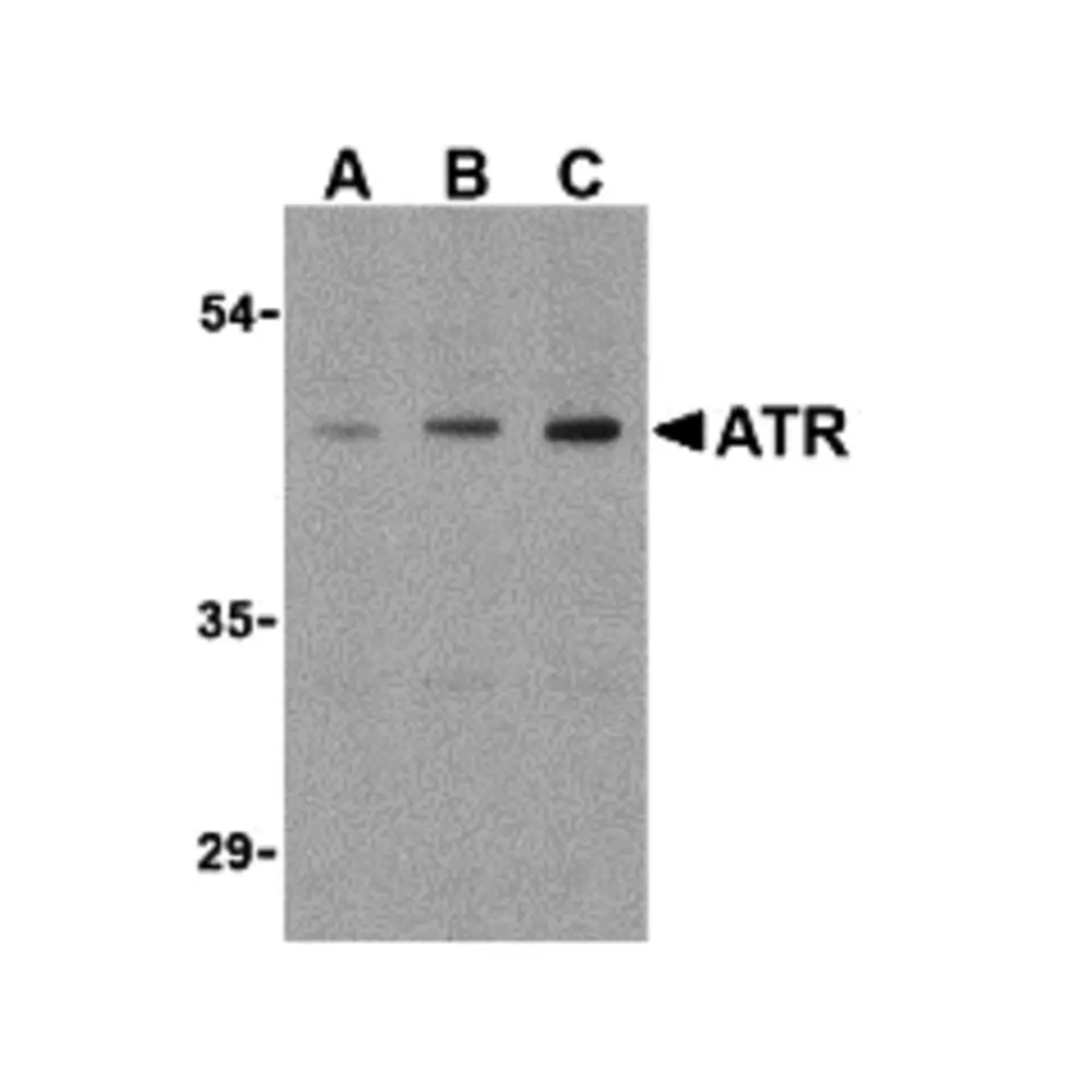 ProSci 3117_S ATR Antibody, ProSci, 0.02 mg/Unit Primary Image