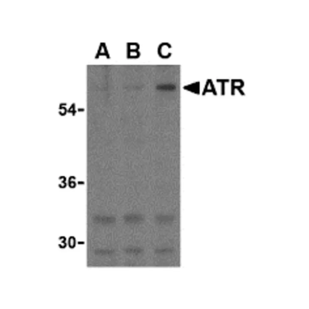 ProSci 3119_S ATR Antibody, ProSci, 0.02 mg/Unit Primary Image
