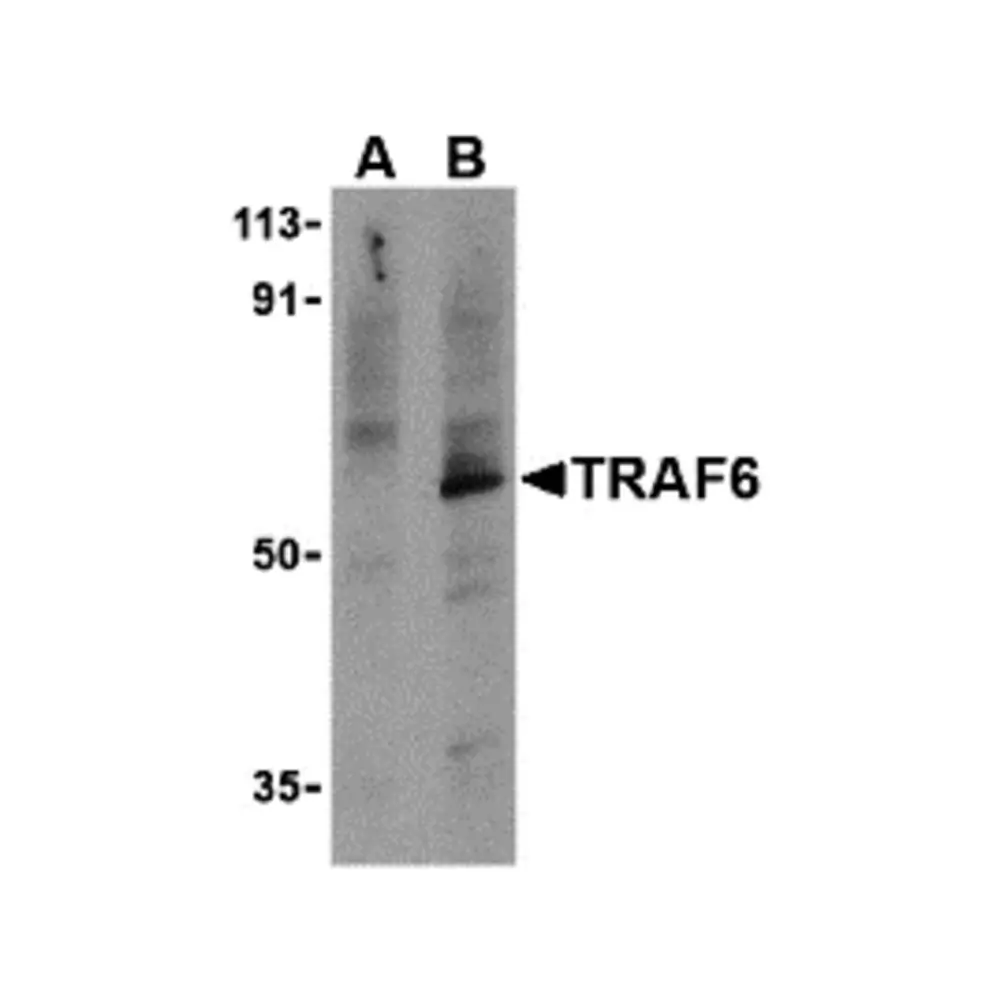 ProSci 3129 TRAF6 Antibody, ProSci, 0.1 mg/Unit Primary Image