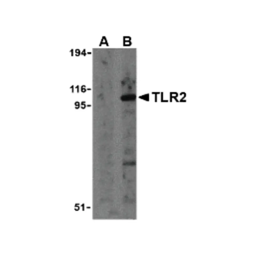 ProSci 3135 TLR2 Antibody, ProSci, 0.1 mg/Unit Primary Image