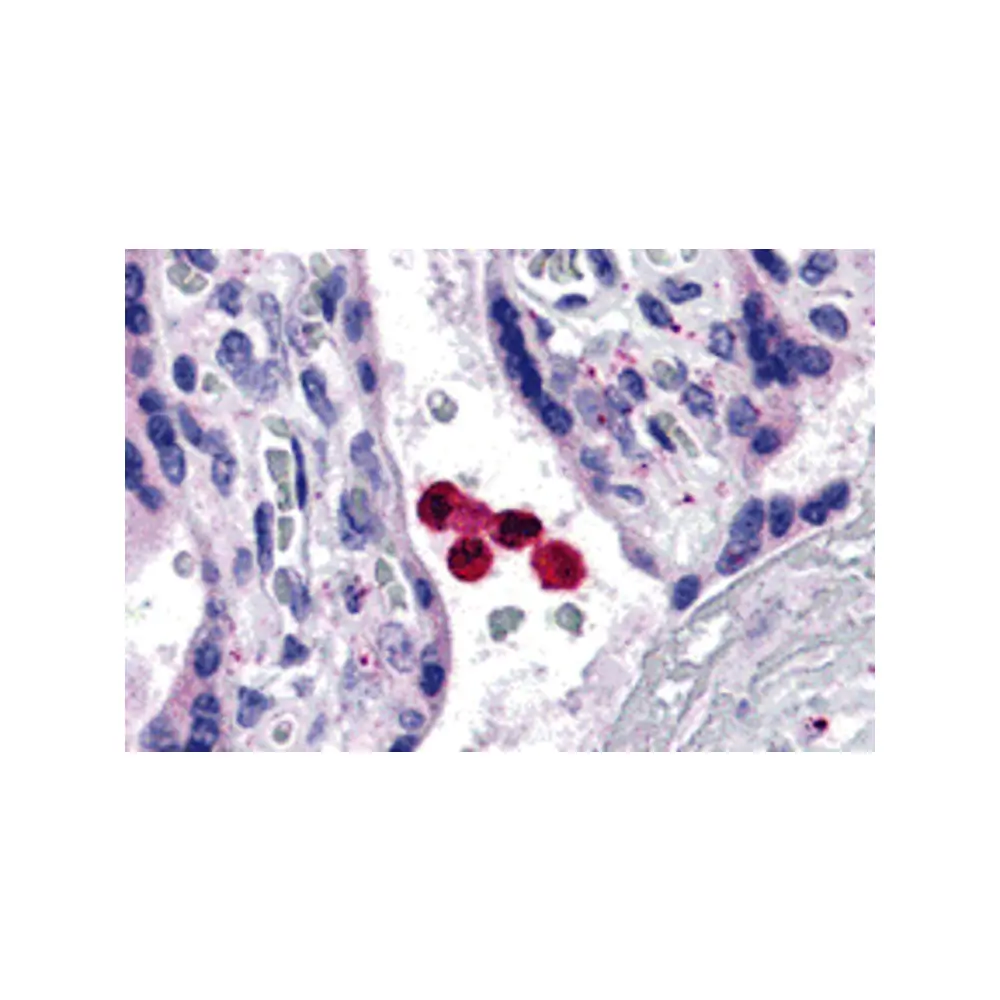 ProSci 3139 TLR4 Antibody, ProSci, 0.1 mg/Unit Primary Image