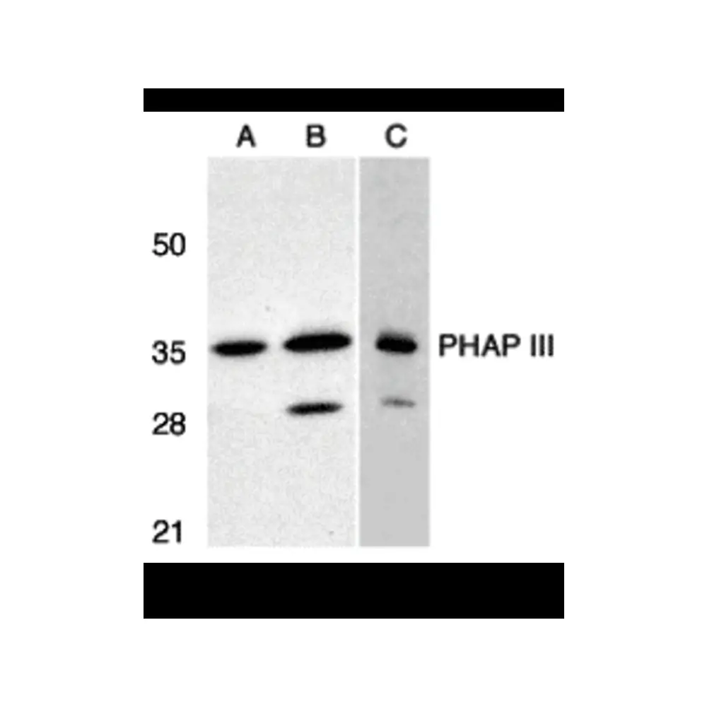 ProSci 3147_S PHAP III Antibody, ProSci, 0.02 mg/Unit Primary Image