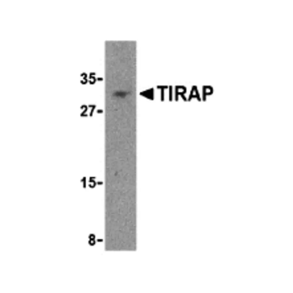 ProSci 3155 TIRAP Antibody, ProSci, 0.1 mg/Unit Primary Image