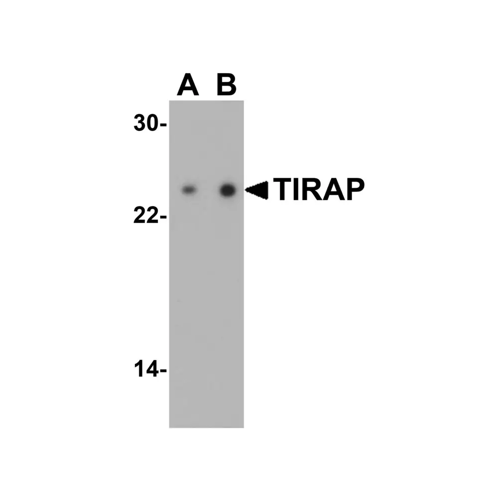 ProSci 3157_S TIRAP Antibody, ProSci, 0.02 mg/Unit Primary Image