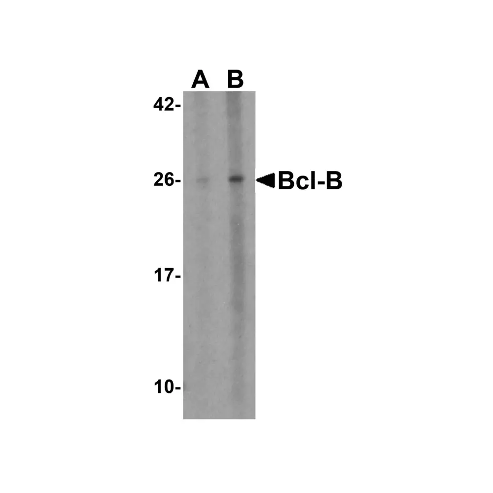 ProSci 3163 Bcl-B Antibody, ProSci, 0.1 mg/Unit Primary Image