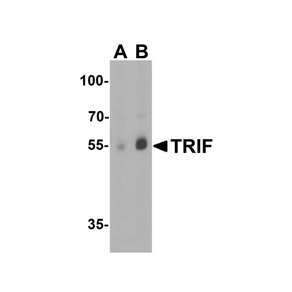 ProSci 3173_S TRIF Antibody, ProSci, 0.02 mg/Unit Primary Image