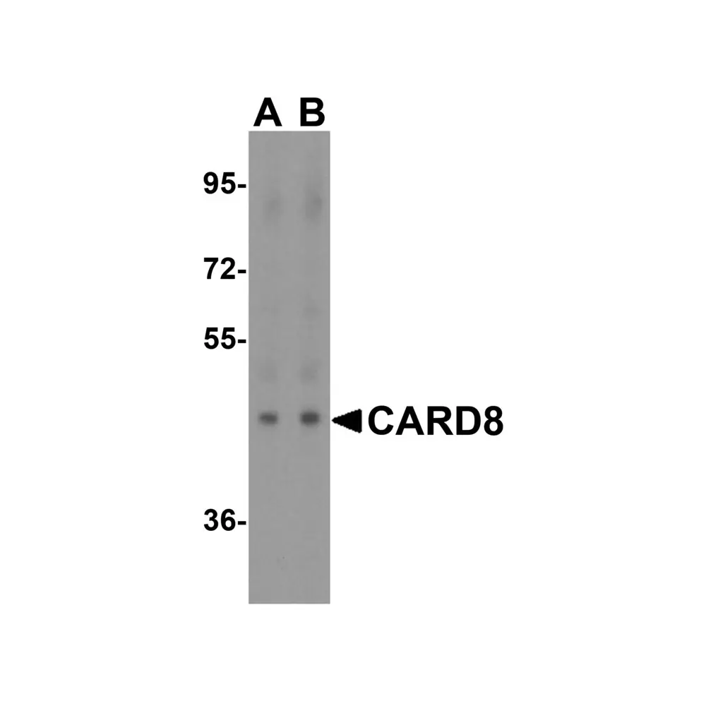 ProSci 3187_S CARD8 Antibody, ProSci, 0.02 mg/Unit Primary Image